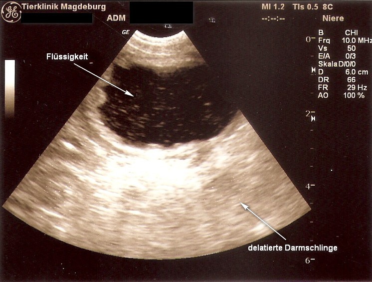 Sono des hinteren Bauchraums